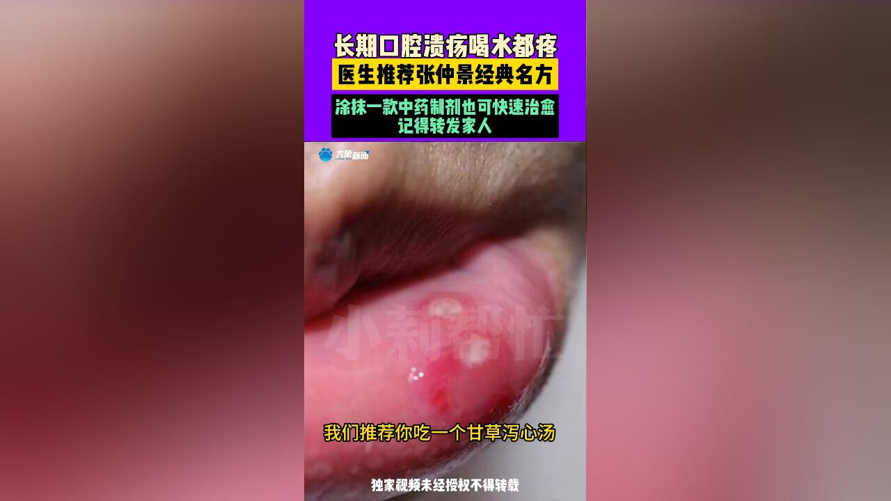 长期口腔溃疡喝水都疼,医生推荐张仲景经典名方,涂抹一款中药制剂也可快速治愈,记得转发家人