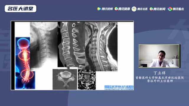 《名医大讲堂》188期 丁立祥 办公室“头号杀手”颈椎病,如何防治?