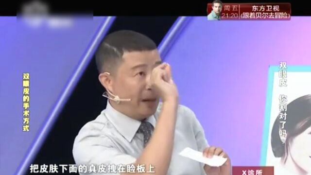 双眼皮 你割对了么!