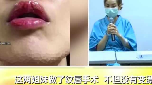 两姐妹为变美一起纹唇,结果双双嘴巴感染烂掉无脸见人