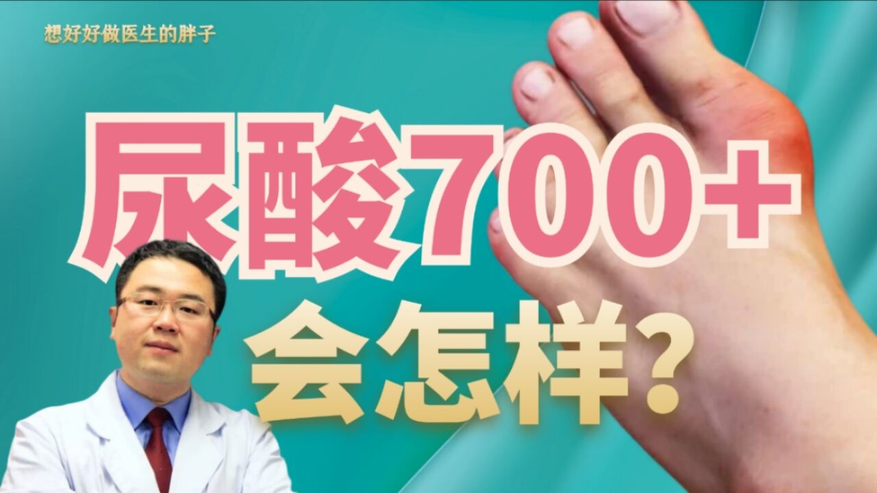 进度条警告:血尿酸超过700会怎样?早晚痛风?医生给您讲清楚