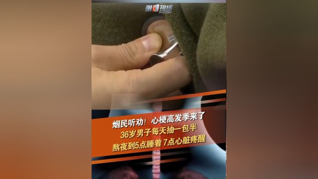 江苏36岁的陈先生在一次大熬夜后,刚睡着胸口疼醒,检查发现他的心脏上一根主要血管被完全堵塞