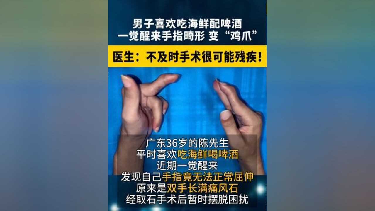 广东男子喜欢吃海鲜 配啤酒 ,一觉醒来手指畸形,变“鸡爪”!医生:不及时手术很可能残疾 !