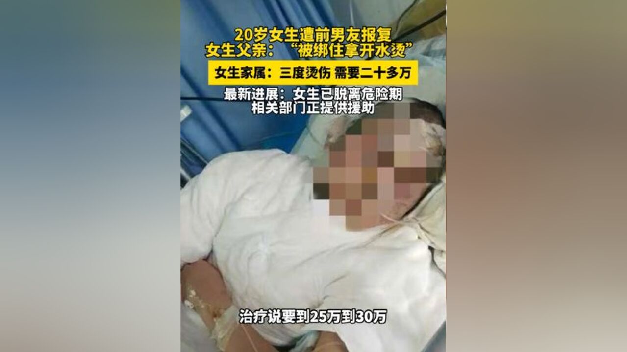 厦门一20岁女生遭前男友报复,女生父亲:“被绑住拿开水烫”,最新进展:女生已脱离危险期 相关部门正提供援助