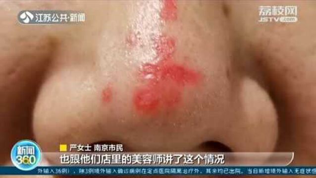 美容变“毁容” 南京这家“香南肌研是黑店” 女子鼻子糜烂留斑