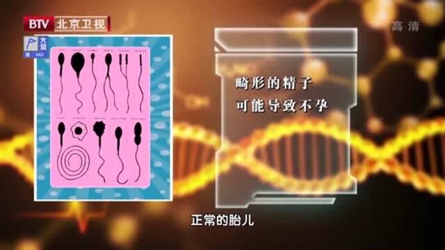 男性的精子数量与质量同样重要,专家简述道理,带你看看健康精子