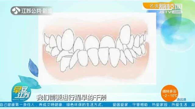 孩子牙齿“地包天”?家长注意 尽早干预矫正很关键!