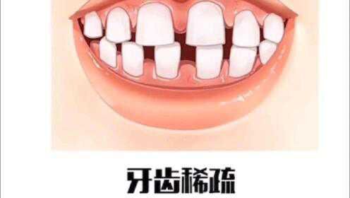 Thumbplayer Poster Plugin Image