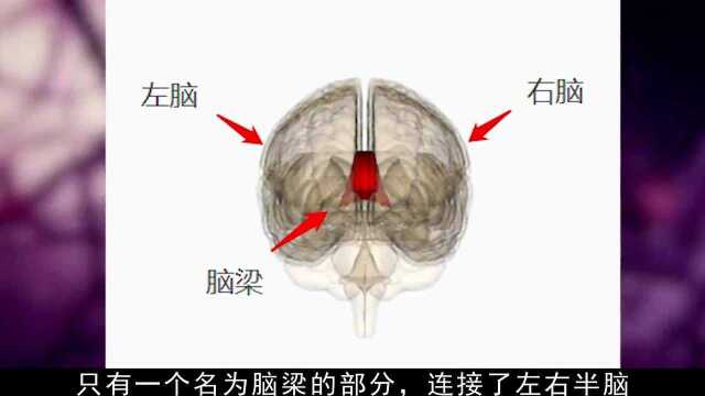 恐怖的“脑梁切断术”