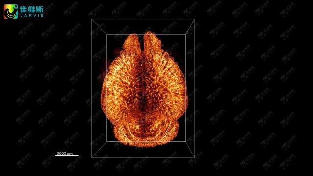 佳维斯生物——小鼠脑血管三维透明成像