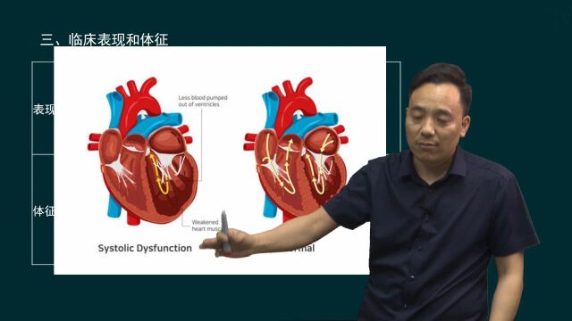 06.感染性心内膜炎、心肌疾病、心包疾病