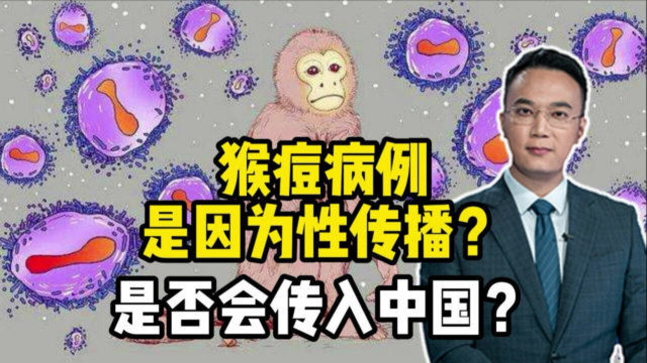 猴痘病例是因为性传播?是否会传入中国?