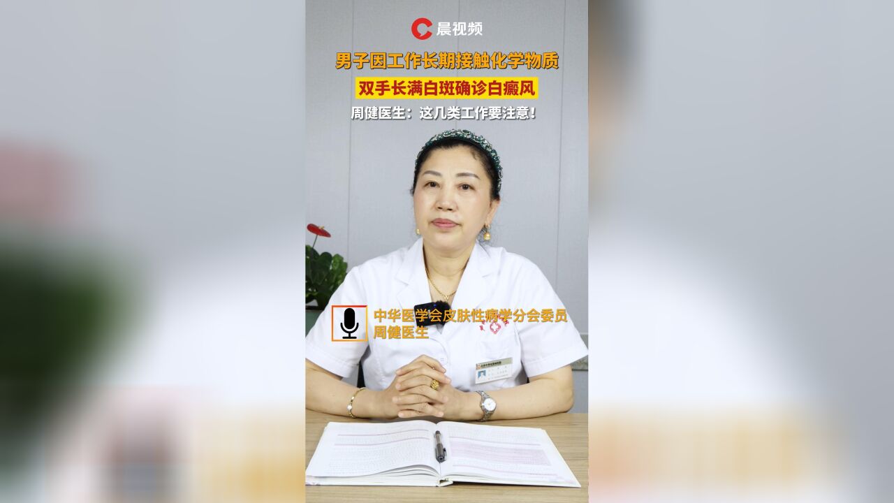 男子因工作长期接触化学物质,双手长满白斑确诊白癜风,周健医生:这几类工作要注意!