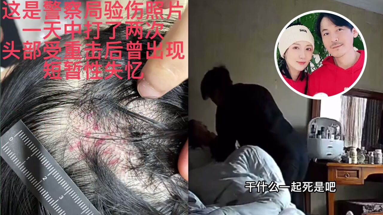 演员王东道歉了!被曝孕期出轨家暴,把老婆掐脖子踹到昏厥失忆