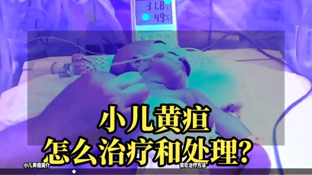 小儿黄疸怎么治疗和处理?