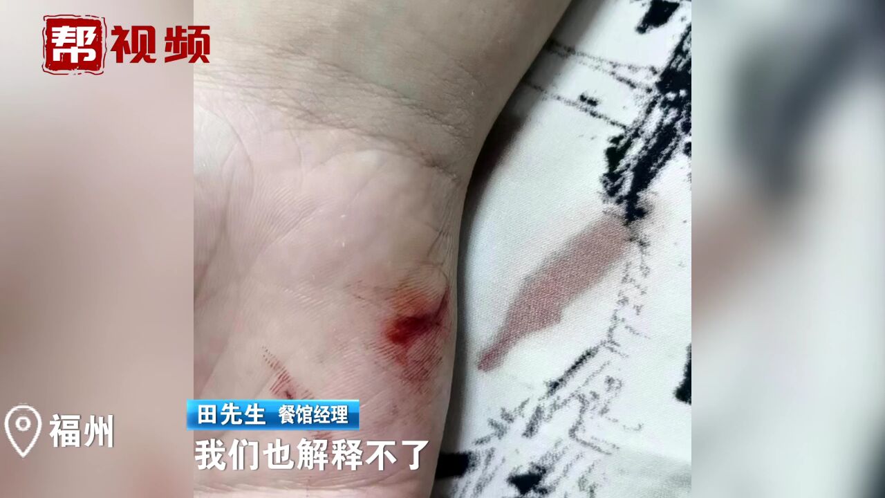 孩子餐馆内追逐 误撞玻璃门被划伤 家长:餐馆应付赔偿责任