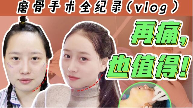 【陪整日记】磨骨全vlog,真的 再痛也值得么?下颌角颧骨