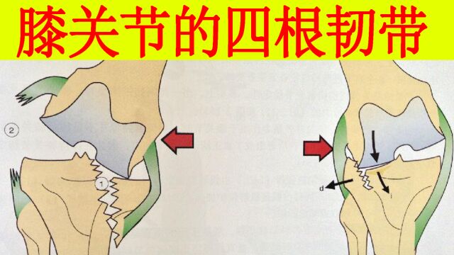 认识一下膝关节的四根韧带,如何判断是否有病,如何治疗?