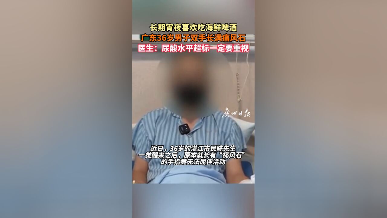 长期宵夜喜欢吃海鲜啤酒 36岁男子双手长满痛风石