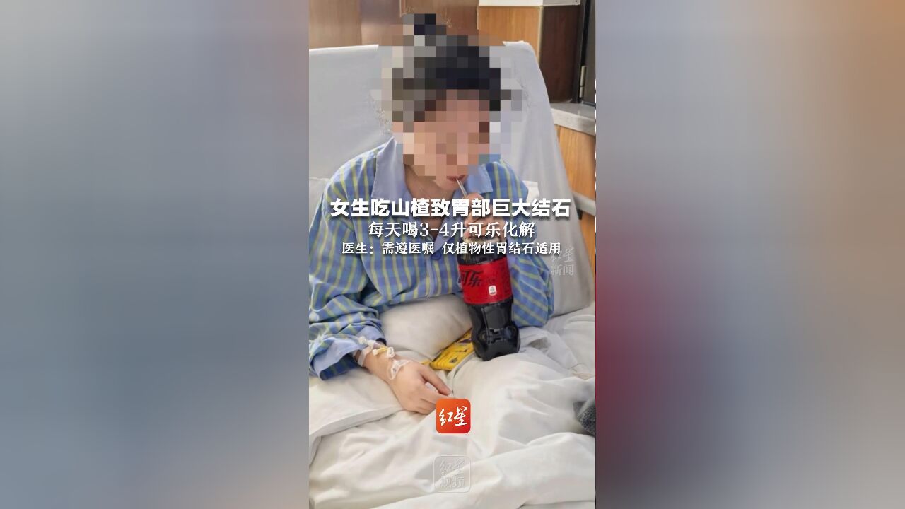 女生吃山楂致胃部巨大结石 每天喝34升可乐化解 医生:需遵医嘱 仅植物性胃结石适用