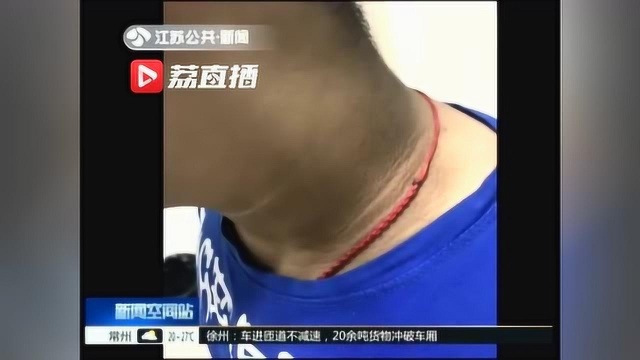 11岁男孩把碳酸饮料当水喝,脖子污黑患上黑色棘皮症