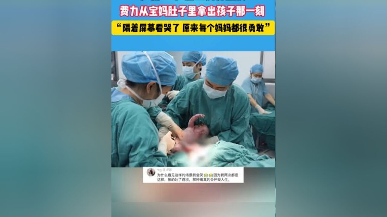 产房一幕 医生划开肚皮,费力从宝妈肚子里拿出孩子那一刻,隔着屏幕都看哭了