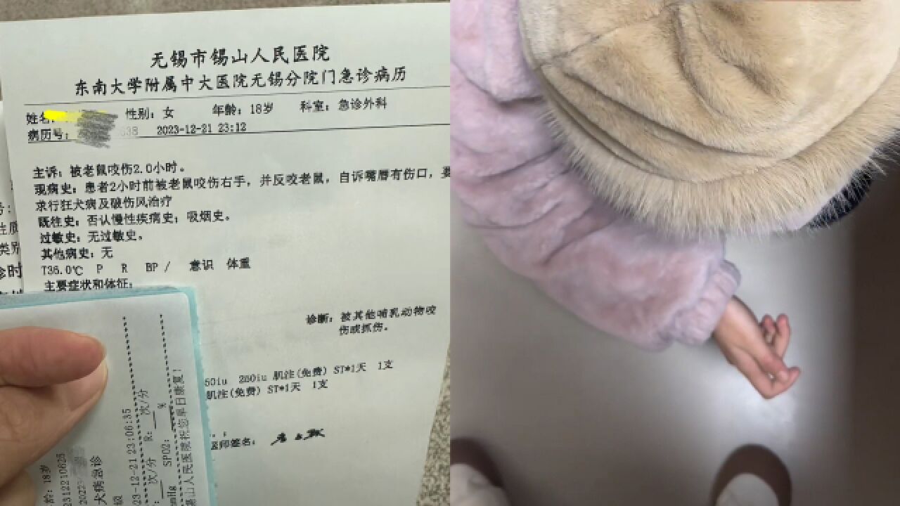 女生被老鼠咬后反咬一口,老鼠头上留牙印:感觉被挑衅,已打针