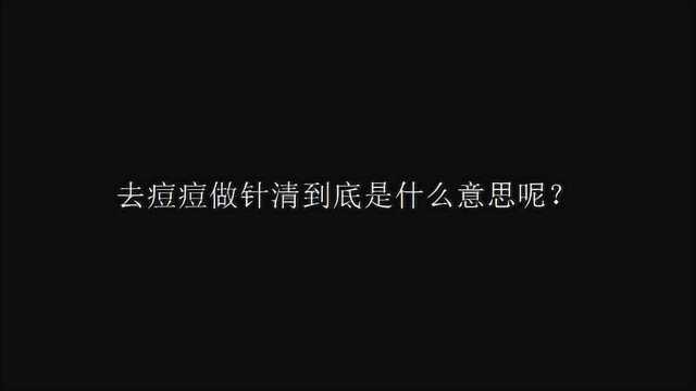 去痘痘做针清到底是什么意思呢?