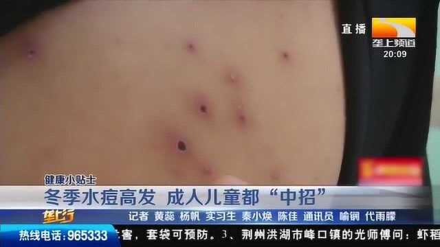 健康小贴士:冬季水痘高发,成人儿童都“中招”