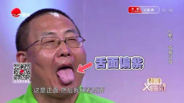 从舌头看健康问题!舌下出现这颜色,你的肝脏怕是要去看医生了