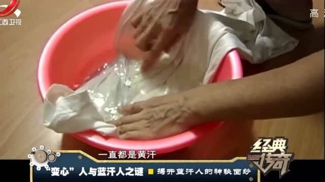 小女孩身体出怪象,汗液呈红色,医院检查:罕见血汗症