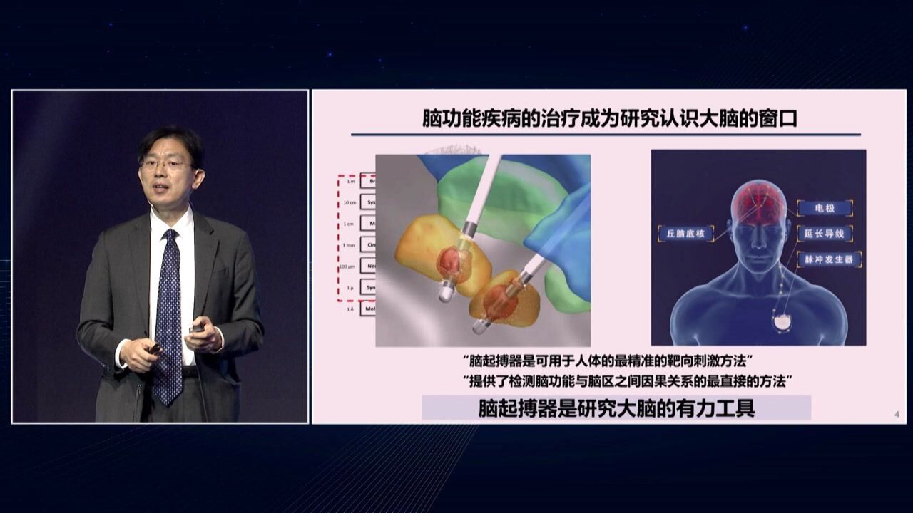 清华大学航天航空学院教授李路明:脑起搏器从临床到脑疾病研究