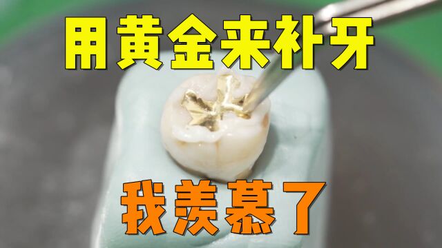 种一颗金牙是种什么体验?