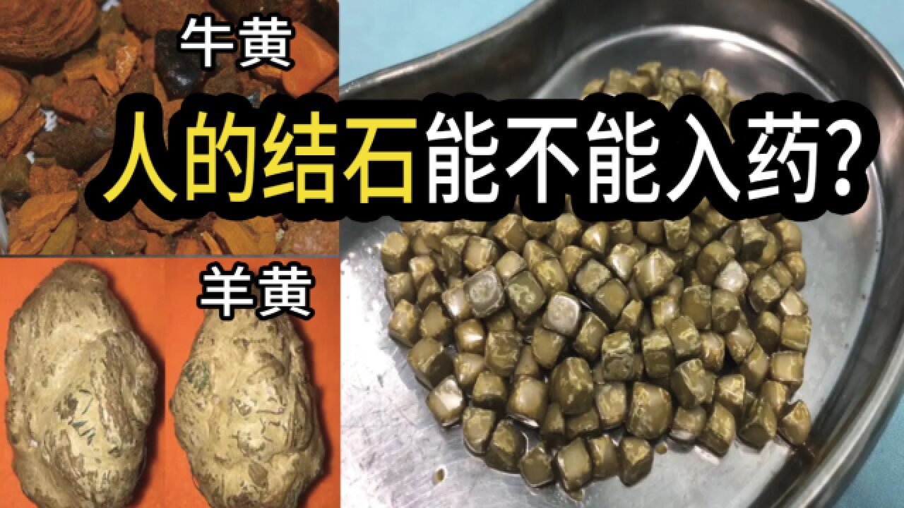 动物结石可以入药?人的可不可以?