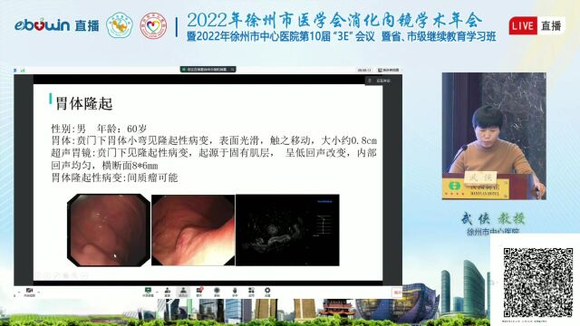 2022年徐州市医学会消化内镜学术年会武侠教授