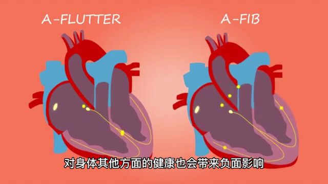 腐乳是营养佳品还是“致癌杀手”?困扰多年,国家公认结果来了