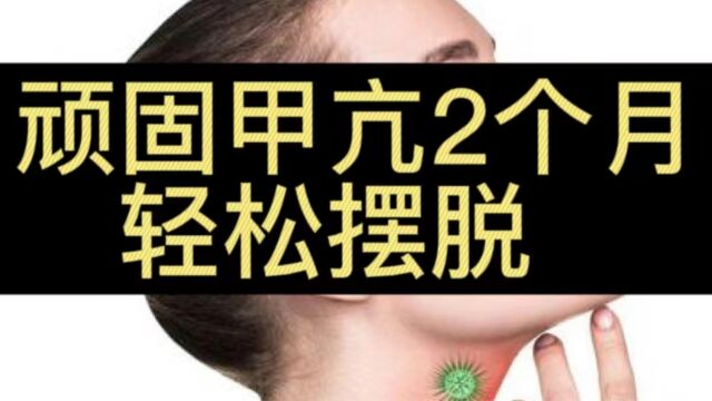 朋友圈传疯了!甲亢患者治愈仅仅用时45天,后悔没早点知道!!