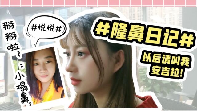 【鼻综合vlog】只不过动了一下这里,土妹变“安吉拉” !