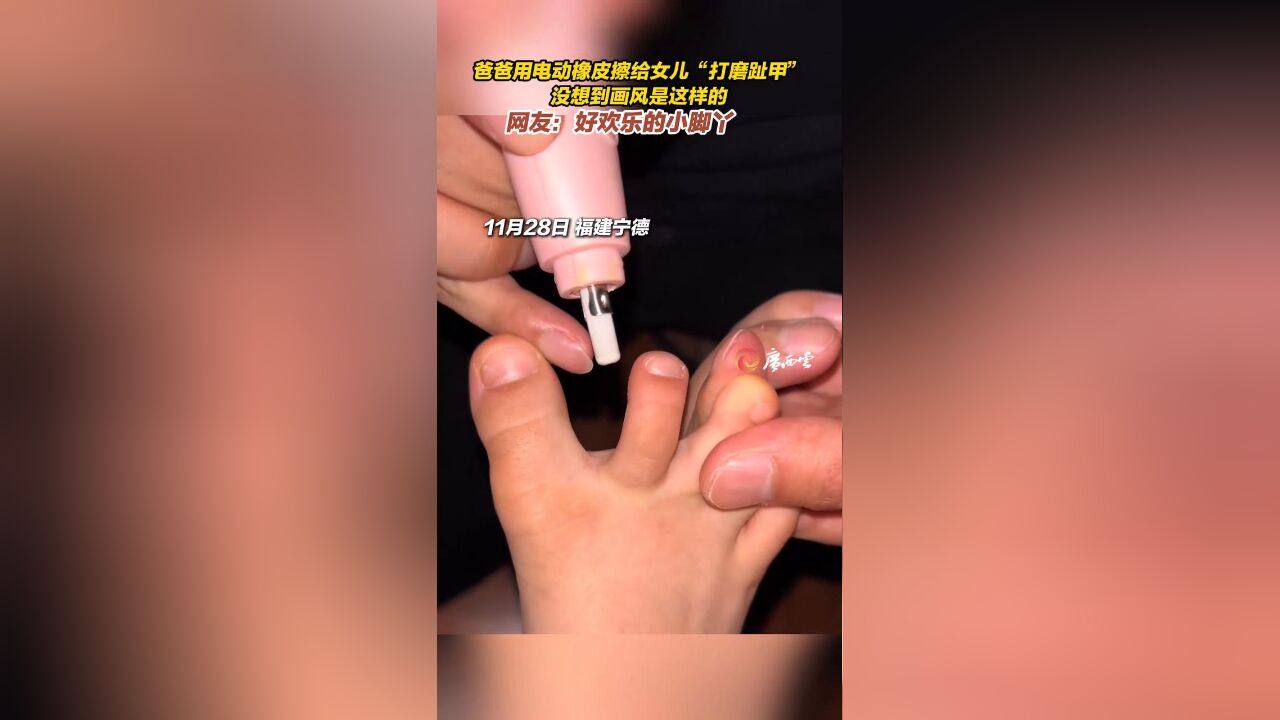 爸爸用电动橡皮擦给女儿“打磨趾甲”