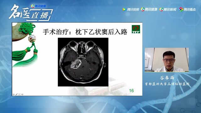 《名医大讲堂》349期 谷春雨 出现耳鸣不要轻视 可能是听神经肿瘤.