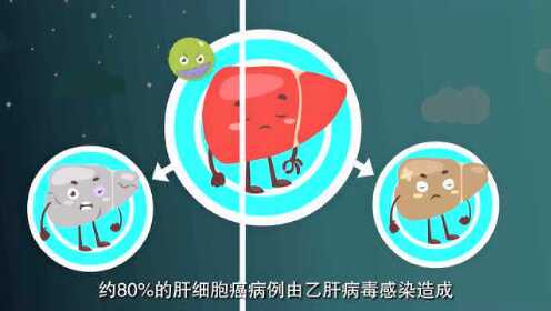 你了解乙肝吗 - 腾讯视频