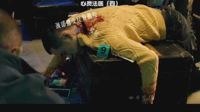 狼人案上:狼人综合症