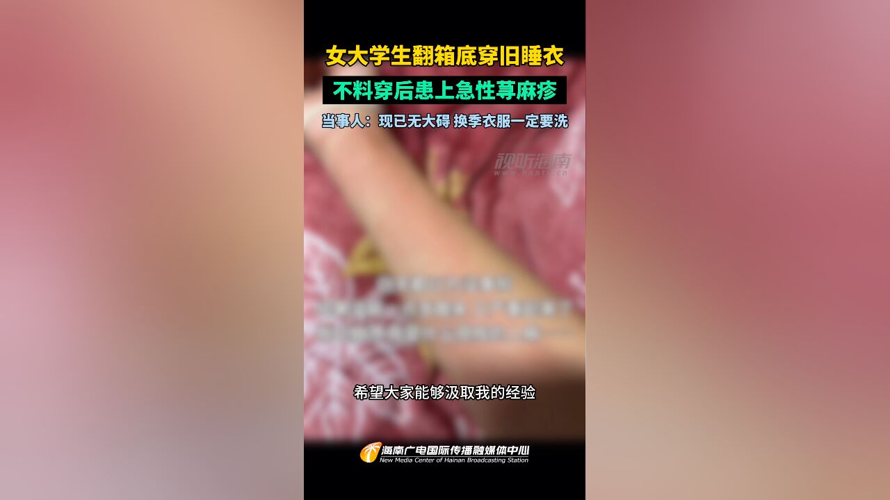 女大学生翻箱底穿旧睡衣 不料穿后患上急性荨麻疹