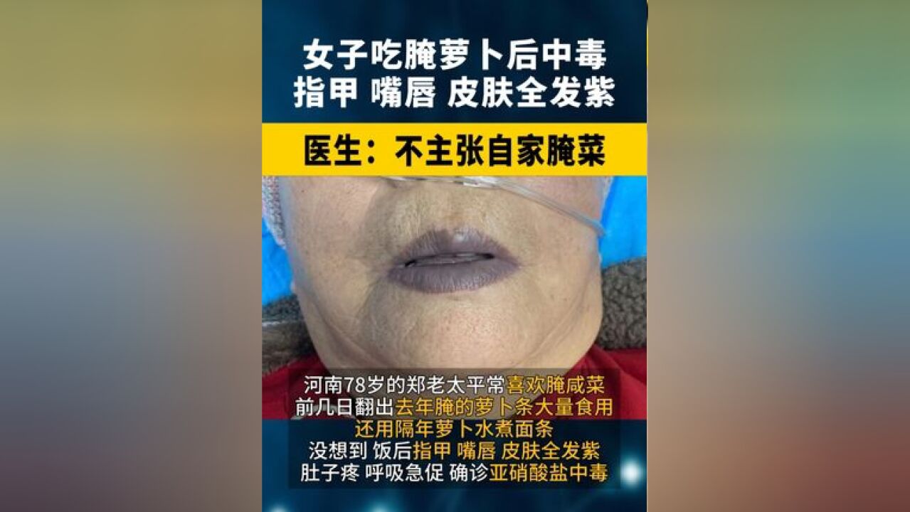 河南女子吃腌萝卜后中毒,指甲、嘴唇、皮肤全发紫!医生:不主张自家腌菜