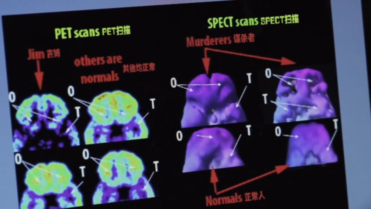 环境因素对携带危险基因的人成长有何影响?科学家亲证实验!