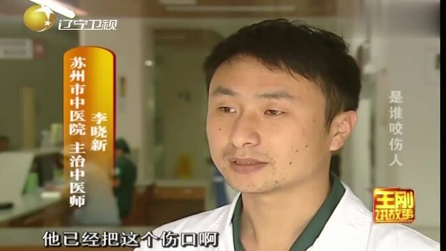 22岁小伙惨遭毒蛇咬伤,现场医生看到毒蛇,顿时傻眼了