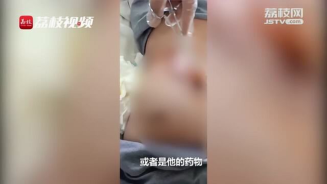 网曝河南杞县患者针灸后集体感染 官方回应:涉事医生已接受调查