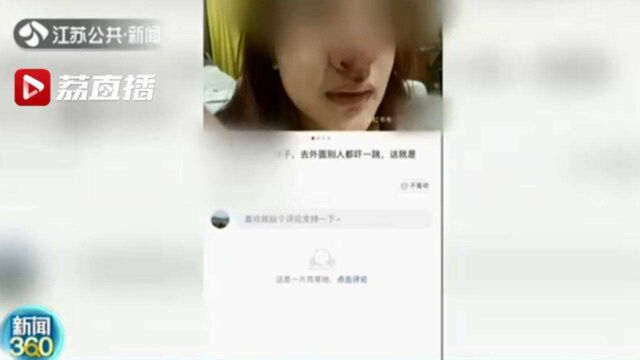 女孩“猪鼻”照满天飞被诬整容失败 其实只是鼻子被撞