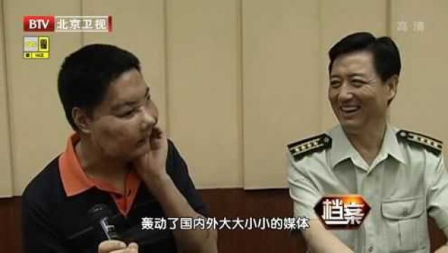 李国兴术后百天,带着新脸走上演讲台,成为众人焦点