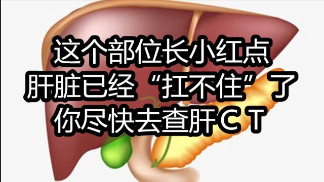 这个部位长“小红点”,也许肝脏已经“扛不住”了,最好早点查CT